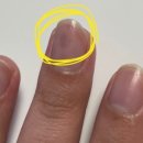 에스엘서울병원 이미지