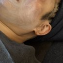 해독이 디톡스 | 부산 광안리 피부관리 예윤에스테틱 만족한 디톡스 해독 케어 솔직후기
