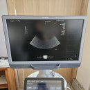 ACUSON S1000 Diagnostic Ultrasound System 이미지
