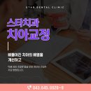 스타교정치과기공소 이미지