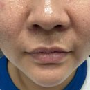 미엔느의원 | 봉담 피부과 미엔느 인모드