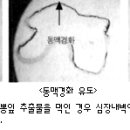 뽕이랑 귀농이랑 이미지