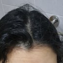 케이메드 | 쌍각자궁 둘째 출산 3일차 -대전더블유여성병원