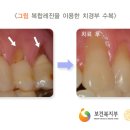 미듬치과 네이버블로그