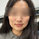 플라덴성형외과 이미지