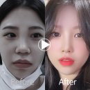 앤플러스의원 티스토리