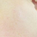 옐로우케어 이미지