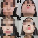 서울퀸성형외과의원 이미지