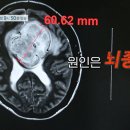 서울아산신경외과