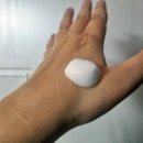 라성약국 | 칸디다질염 자연치유 해결법 완벽 정리!