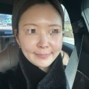 국립중앙의료원 | [공지] 성인아토피 치료 연대기 | 올루미언트,아트랄자 후기<국립중앙의료원>