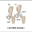 허벅지 ㅡ 대퇴사두근과 대퇴이두근 이미지