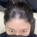 하프톤 스칼프 | 동성로smp 하프톤스칼프 대구 두피관리 1회차 후기