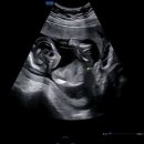 목포미즈아이병원 이미지