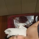 더프라나롬