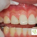 민치아치과기공소 이미지