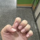 네일운