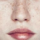 더힐피부과의원 이미지