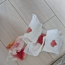 케이에스병원 | 칼에 베였을때 병원은 정형외과 손가락 꼬매기 봉합 후기 비용