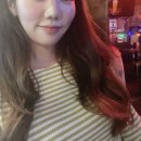 애비뉴퍼스트약국 | 큰 점제거수술 6개월 경과 후기