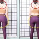 아람메디 이미지