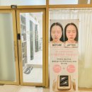 춘천웨딩관리] 드레스핏 살리는 꿀팁 ! 예다움 오토젯 팔뚝관리(오토젯/싸이블로/주차)