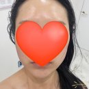 블랑스킨앤바디