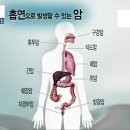 불만제로] 보이지 않는 살인, 강제 흡연 = 간접흡연 (스압주의~) 이미지