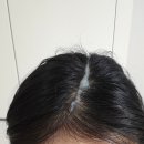 [쏜직한후기] 탈모예방 : 두피도 관리해야지 : 포뷰트 두피 스케일러
