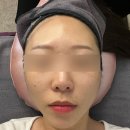 백령로 | 춘천 피부관리 뷰티오로라엘 본점 미백관리로 글루타치온 화이트토닝 받은 찐 후기