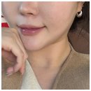 성수의원 | 밴스의원 성수 포텐자콜라스터 3회차 후기