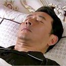 오디한의원 | 압구정성형외과 절개 모발이식 1~3일차 여자 헤어라인 교정 내돈내산 후기