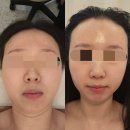 김밥나라신창점 | 광주 신창동 피부관리 하이푸리프팅 더맑은스킨