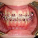 뉴욕브레이스치과의원 이미지