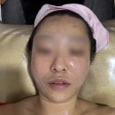 도원동 더채움 뷰티샵 탄력up 고주파 윤곽관리 후기｜10주년 이벤트 중