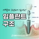 임플란티아치과의원 충주점 네이버블로그