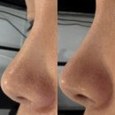 헬스케어119 부산본점 | 서면피부관리, 뷰티119 트라이엄케어로 모공관리