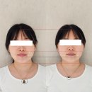 실시간 변화를 볼 수 있는 "여러분의 얼굴선생님 강남 2호점" 얼굴 경락, 도수, 에스테틱 받은 후기