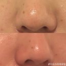 이오스타 이미지