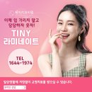 제아치과에서 라미네이트 후기!!관리 방법은?