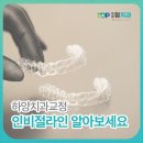 하양탑치과의원 | 하양교정치과, 인비절라인 알아보세요
