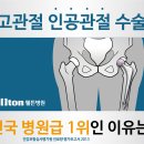 고괸절인공관절수술/ 고관절인공관절치환술 잘하는곳 이미지