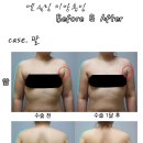 믿고 수술하는 지방흡입 전문병원! 엔슬림 이미지