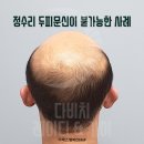 디에스가발