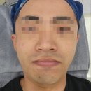 예원스킨케어 | 신림피부관리 1:1맞춤케어 "하얀스킨앤바디" 후기!!!