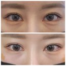 수원역예쁨주의쁨의원 이미지