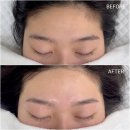지저분한 헤어라인 해결 후기 영통역 피부관리 왁싱 뷰티율
