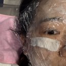 오이도역 | 시흥 오이도역 피부과 : 배곧 신부 피부관리 고주파 리프팅 텐써마 300샷 후기