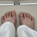 김수정뷰티 | 가양역발톱관리 멍든 발톱 복구 후기🦶🏻 김수정 뷰티 가양역점 | 발톱도 스케일링이 필요하다!