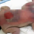 신생아 2명 산부인과병원 인큐베이터에서 중화상 이미지